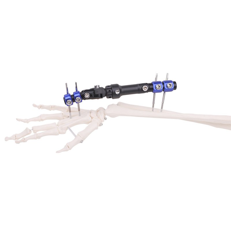 Wrist External Fixation Series