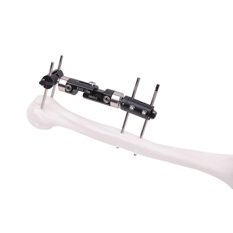 Dynamic Axial External Fixation Series