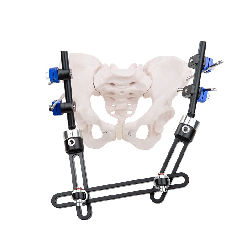 Pelvic & Bone Transport External Fixation Series