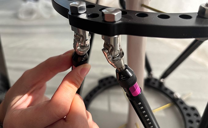 Flexible Postoperative Adjustability